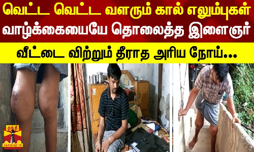 வெட்ட வெட்ட வளரும் கால் எலும்புகள்.. வாழ்க்கையையே தொலைத்த இளைஞர் - வீட்டை விற்றும் தீராத அரிய நோய்