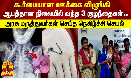 கூர்மையான ஊக்கை விழுங்கிஆபத்தான நிலையில் வந்த 3 குழந்தைகள்..அரசு மருத்துவமனை செய்த நெகிழ்ச்சி செயல்