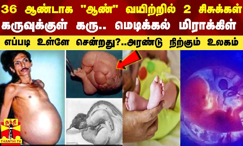 36 ஆண்டாக ஆண் வயிற்றில் 2 சிசுக்கள்.. கருவுக்குள் கரு.. மெடிக்கல் மிராக்கிள்-அரண்டு நிற்கும் உலகம்