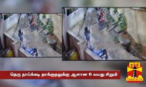 தெரு நாய்க்கடி தாக்குதலுக்கு ஆளான 6 வயது சிறுமி- பரபரப்பான  சிசிடிவி காட்சிகள்