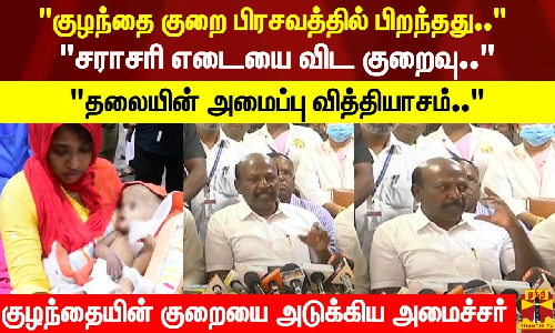 குழந்தை குறை பிரசவத்தில் பிறந்தது..சராசரி எடையை விட குறைவு..தலையின் அமைப்பு வித்தியாசம்..குழந்தையின் குறையை அடுக்கிய அமைச்சர்