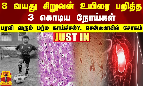 #JUSTIN || 8 வயது சிறுவன் உயிரை பறித்த 3 கொடிய நோய்கள்-பரவி வரும் மர்ம காய்ச்சல்.. சென்னையில் சோகம் #JUSTIN || 8 வயது சிறுவன் உயிரை பறித்த 3 கொடிய நோய்கள்-பரவி வரும் மர்ம காய்ச்சல்.. சென்னையில் சோகம்