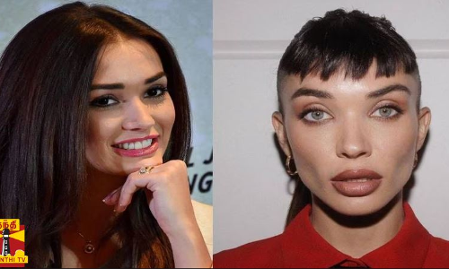 ப்ளாஸ்டிக் சர்ஜரி செய்துள்ள எமி ஜாக்சன்