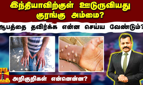 இந்தியாவிற்குள் ஊடுருவியது குரங்கு அம்மை? ஆபத்தை தவிர்க்க என்ன செய்ய வேண்டும்? அறிகுறிகள் என்னென்ன? இந்தியாவிற்குள் ஊடுருவியது குரங்கு அம்மை? ஆபத்தை தவிர்க்க என்ன செய்ய வேண்டும்? அறிகுறிகள் என்னென்ன?