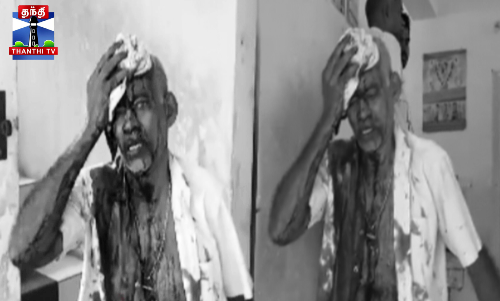 மண்டையை பிளந்த மனைவி? - ரத்தம் சொட்ட சொட்ட புகார்