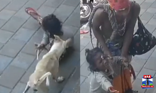 சாலையில் நடந்து சென்ற சிறுமியைக் கடித்த தெருநாய்/தெருநாய் கடிக்கும் அதிர்ச்சிகர சிசிடிவி காட்சிகள் வெளியீடு