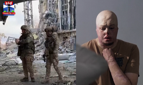 உடலை வதைத்த போர்க்கள காயங்கள்... மனதை தளரவிடாத ராணுவ வீரர்கள்