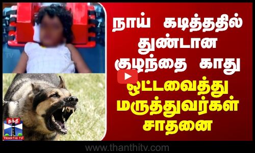 Kerala Dog Bite | நாய் கடித்ததில் துண்டான குழந்தையின் காது - ஒட்டவைத்து மருத்துவர்கள் சாதனை
