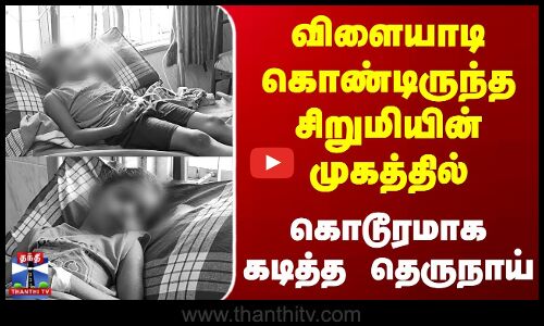 விளையாடி கொண்டிருந்த சிறுமியின் முகத்தில் கொடூரமாக கடித்த தெருநாய்