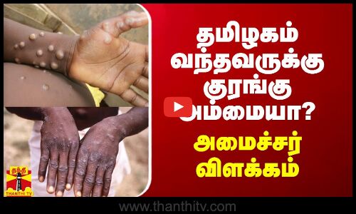 தமிழகம் வந்தவருக்கு குரங்கு அம்மையா?.. அமைச்சர் விளக்கம்