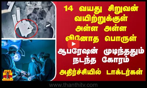 14 வயது சிறுவன் வயிற்றுக்குள் அள்ள அள்ள வினோத பொருள்... ஆபரேஷன் முடிந்ததும் நடந்த கோரம்...
