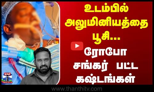 உடம்பில் அலுமினியத்தை பூசி... ரோபோ சங்கர் பட்ட கஷ்டங்கள்