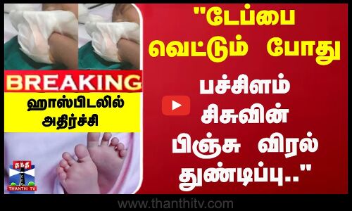 Breaking | Hospital | Baby | டேப்பை வெட்டும் போது... பச்சிளம் சிசுவின் விரல் துண்டிப்பு...