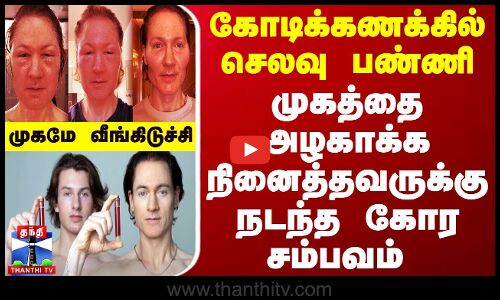 கோடிக்கணக்கில் செலவு பண்ணி முகத்தை அழகாக்க நினைத்தவருக்கு நடந்த கோர சம்பவம் - முகமே வீங்கிடுச்சி