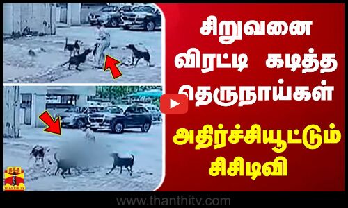 சிறுவனை விரட்டி கடித்த தெருநாய்கள் - அதிர்ச்சியூட்டும் சிசிடிவி