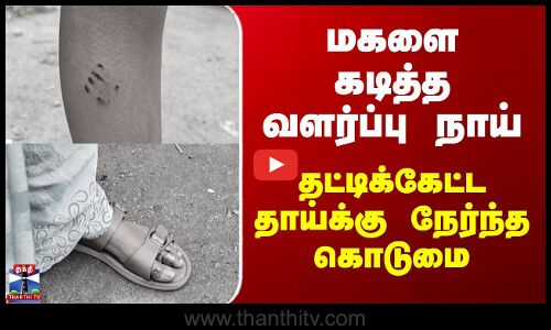 Pet Dog Issue | மகளை கடித்த வளர்ப்பு நாய் - தட்டிக்கேட்ட தாய்க்கு நேர்ந்த கொடுமை