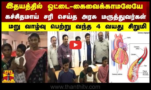 இதயத்தில் ஓட்டை - கை வைக்காமலேயே கச்சிதமாய் சரி செய்த அரசு மருத்துவர்கள்..
