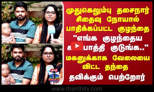 Kovai SMA Child | முதுகெலும்பு தசைநார் சிதைவு நோயால் பாதிக்கப்பட்ட குழந்தை..தவிக்கும் பெற்றோர்
