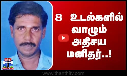8 உடல்களில் வாழும் அதிசய மனிதர்..!