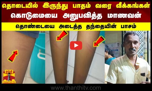 தொடையில் இருந்து பாதம் வரை வீக்கங்கள் - கொடுமையை அனுபவித்த மாணவன் - தொண்டையை அடைத்த தந்தையின் பாசம்