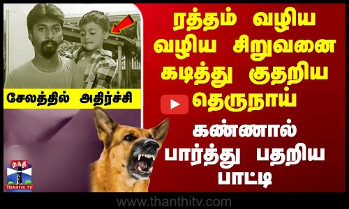 ரத்தம் வழிய வழிய சிறுவனை கடித்து குதறிய தெருநாய் - கண்ணால் பார்த்து பதறிய பாட்டி