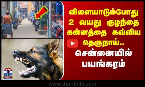 Chennai Dog Bite | விளையாடும்போது 2 வயது குழந்தை கன்னத்தை கவ்விய தெருநாய்.. சென்னையில் பயங்கரம்