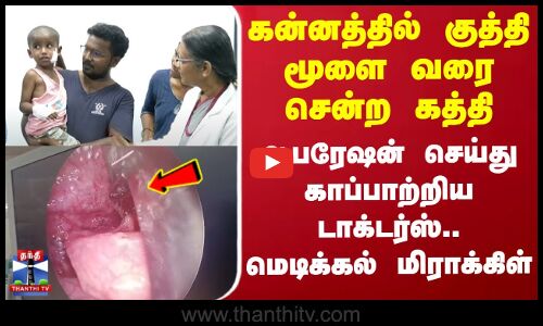 கன்னத்தில் குத்தி மூளை வரை சென்ற கத்தி - ஆபரேஷன் செய்து காப்பாற்றிய டாக்டர்ஸ்.. மெடிக்கல் மிராக்கிள்