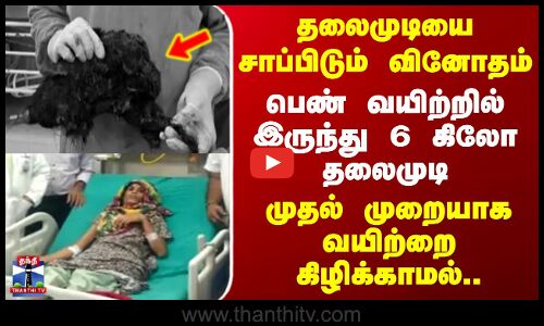 Rajasthan | தலைமுடியை சாப்பிடும் வினோதம்.. வயிற்றில் இருந்து 6 கிலோ தலைமுடி - வயிற்றை கிழிக்காமல்..