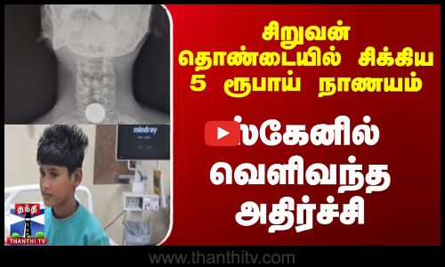 சிறுவன் தொண்டையில் சிக்கிய 5 ரூபாய் நாணயம்...ஸ்கேனில் வெளிவந்த அதிர்ச்சி