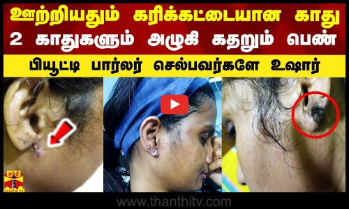 ஊற்றியதும் கரிக்கட்டையான காது.. 2 காதுகளும் அழுகி கதறும் பெண்.. பியூட்டி பார்லர் செல்பவர்களே உஷார்