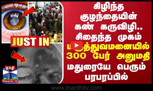கிழிந்த குழந்தையின் கண் கருவிழி.. சிதைந்த முகம் - மருத்துவமனையில் 300 பேர் அனுமதி - மதுரையே பெரும் பரபரப்பில்