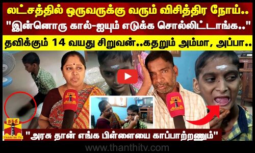 லட்சத்தில் ஒருவருக்கு வரும் விசித்திர நோய்..தவிக்கும் 14 வயது சிறுவன்..கண்ணீர் கடலில் அம்மா, அப்பா..