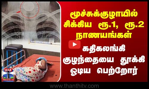 மூச்சுக்குழாயில் சிக்கிய ரூ.1, ரூ.2 நாணயங்கள் - கதிகலங்கி குழந்தையை தூக்கி ஓடிய பெற்றோர்