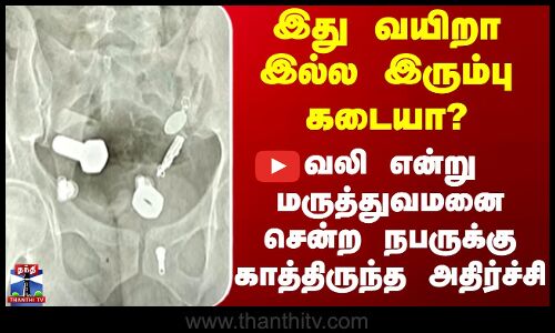 Stomach Pain| இது வயிறா இல்ல இரும்பு கடையா? வலி என்றுமருத்துவமனைசென்ற நபருக்கு காத்திருந்த அதிர்ச்சி