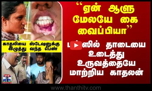 ``ஏன் ஆளு மேலயே கை வைப்பியா’’ - பஸ்ஸில் தாடையை உடைத்து உருவத்தையே மாற்றிய காதலன்