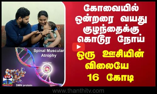 கோவையில் ஒன்றரை வயது குழந்தைக்கு கொடூர நோய் - ஒரு ஊசியின் விலையே 16 கோடி