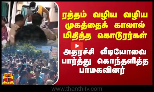 ரத்தம் வழிய வழிய முகத்தைக் காலால் மிதித்த கொடூரர்கள்... அதிர்ச்சி வீடியோவை பார்த்து கொந்தளித்த பாமகவினர்