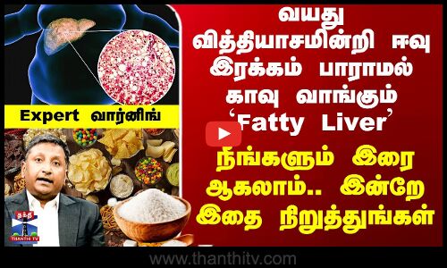 Fatty Liver Avoid Foods | வயது வித்தியாசமின்றி காவு வாங்கும் `Fatty Liver’ - Expert வார்னிங்