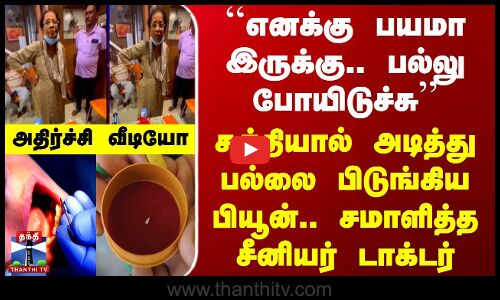 ``எனக்கு பயமா இருக்கு.. பல்லு போயிடுச்சு - சுத்தியால் அடித்து பல்லை பிடுங்கிய பியூன்.. சமாளித்த சீனியர் டாக்டர்