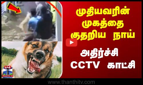 முதியவரின் முகத்தை குதறிய நாய் அதிர்ச்சி CCTV காட்சி