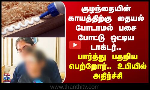 Uttarpradesh Doctor Issue | குழந்தையின் காயத்திற்கு தையல் போடாமல் பசை போட்டு ஒட்டிய டாக்டர்..