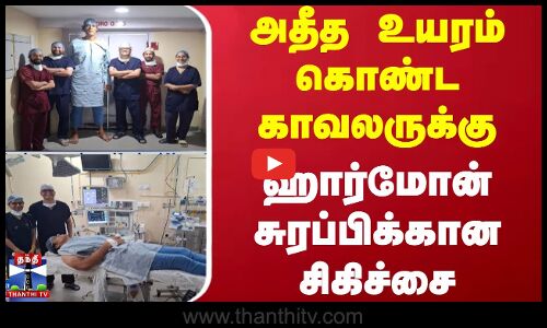 அதீத உயரம் கொண்ட காவலருக்கு ஹார்மோன் சுரப்பிக்கான சிகிச்சை