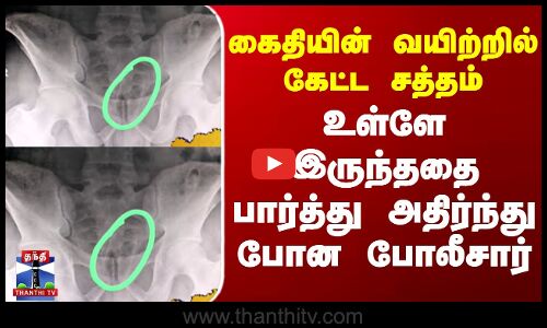 Salem | Jail | கைதியின் வயிற்றில் கேட்ட சத்தம் - உள்ளே இருந்ததை பார்த்து அதிர்ந்து போன போலீசார்