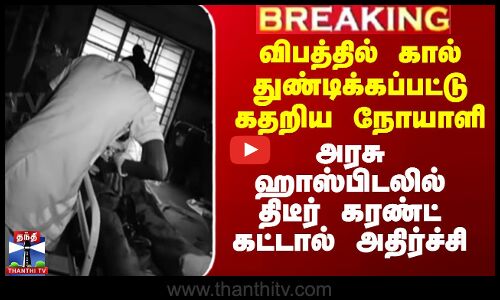 விபத்தில் கால் துண்டிக்கப்பட்டு கதறிய நோயாளி - அரசு ஹாஸ்பிடலில் திடீர் கரண்ட் கட்டால் அதிர்ச்சி