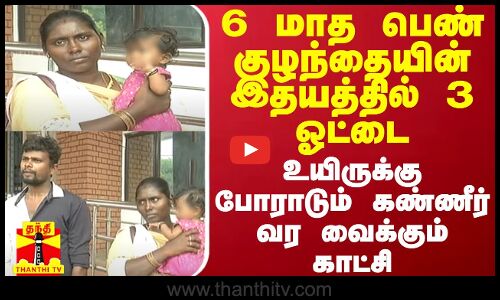 6 மாத பெண் குழந்தையின் இதயத்தில் 3 ஓட்டை - உயிருக்கு போராடும் கண்ணீர் வர வைக்கும் காட்சி