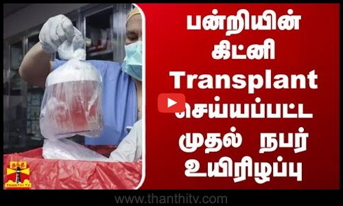 பன்றியின் கிட்னி Transplant செய்யப்பட்ட முதல் நபர் உயிரிழப்பு