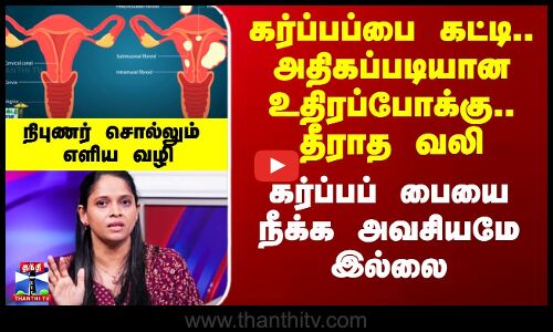 Fibroid Uterus | அதிகப்படியான உதிரப்போக்கு.. தீராத வலி - கர்ப்பப் பையை நீக்க அவசியமே இல்லை