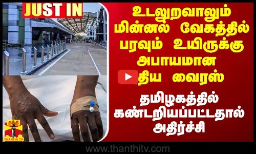 உடலுறவாலும் மின்னல் வேகத்தில் பரவும் உயிருக்கு அபாயமான புதிய வைரஸ் தமிழகத்தில் கண்டறியப்பட்டது
