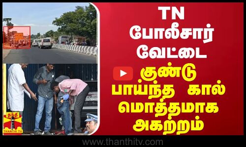 TN போலீசார் வேட்டை - குண்டு பாய்ந்த கால் மொத்தமாக அகற்றம்