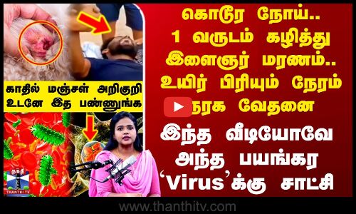 கொடூர நோய்..1 வருடம் கழித்து இளைஞர் மரணம்.. உயிர் பிரியும் நேரம் நரக வேதனை - உடனே இத பண்ணுங்க